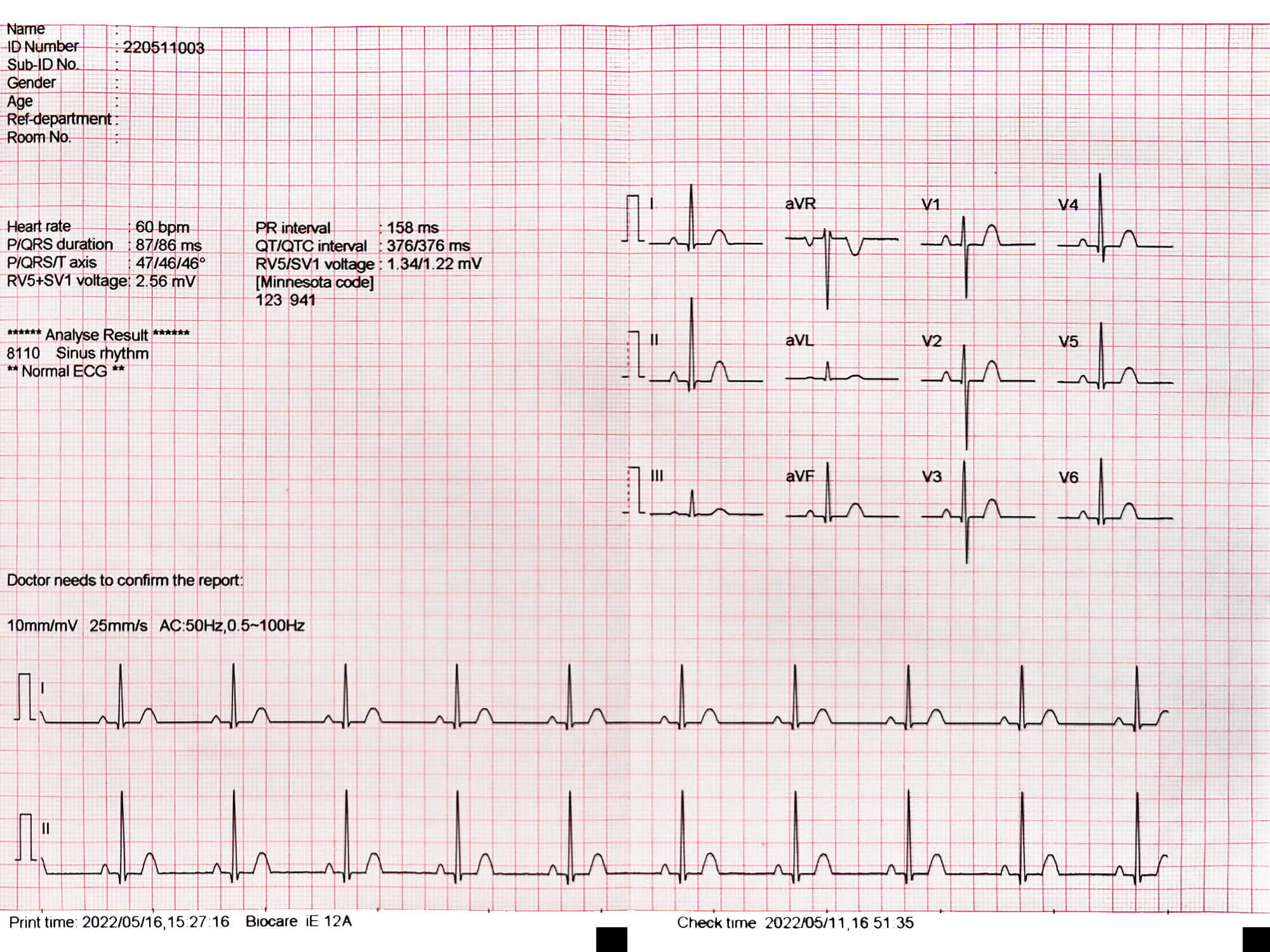 Biocare iE12A ECG Paper (3 packs)